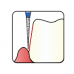 Osung Crown Posterior/ Labial, Axial, Lingual Axial Reduction and Margin/ Proximal Cutting Straight FG Shank 164-10F2(165 8858 010) Fine Grit Diamond Bur 5/PK